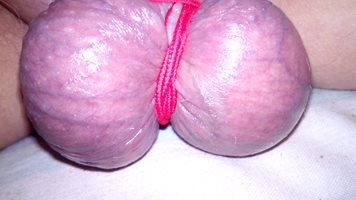 balls ready to milk