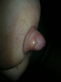 Uses some suckers with pumping..another damm blister on samw nip