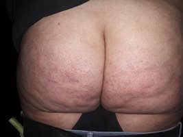 Wifey big fat beautiful cellulite spanked hard asf ass