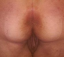 Should I shave my ass?