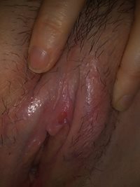 Pinkcunts sore clit from getting eaten!!!
