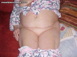 My swollen belly...