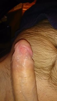 If you like my hard cock pleas coment or vote